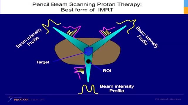 The Basics of Proton Therapy