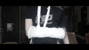 Сломал Руку на Эксперименте!