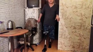Коленный модуль для протеза бедра с замком или без. Как удобней?