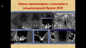 Зубарева А.А. «Диагностика полости носа и околоносовых пазух по данным КЛКТ»