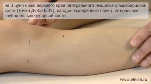 Фригидность