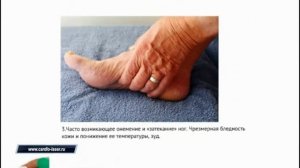 Атеросклероз Атеросклероз нижних конечностей