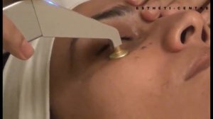 ESTHETI CENTRE OXY JET TREATMENT