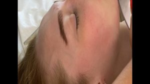 Скулы. Массаж лица. Инструментальный массаж NordBlade. Специалист: Вера Соболевская.