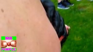 Giant pimple on back - Mr. Pimple