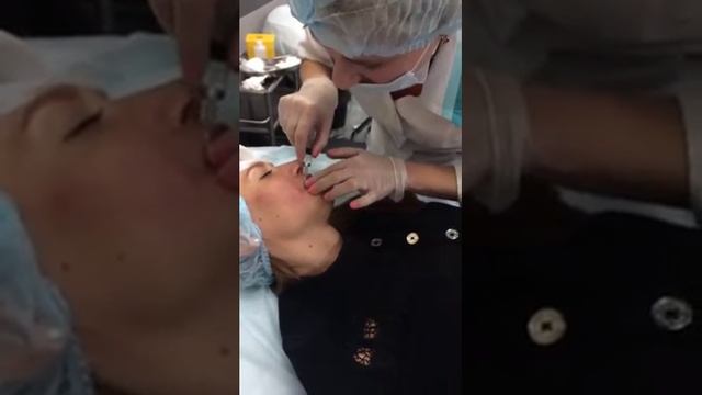 Обучение косметологов , мастер-класс проводит Врач дерматолог - косметолог Хуснутдинова Н.В. смотреть онлайн