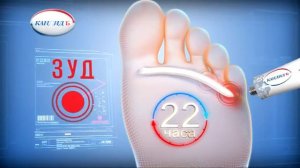 Кандид_"Бассейн"