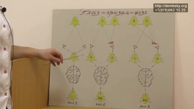 #5 аппарат Елочка. Глазные тренажеры. смотреть онлайн
