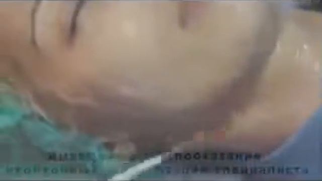 Сделать Кислотный Пилинг в домашних условиях смотреть онлайн