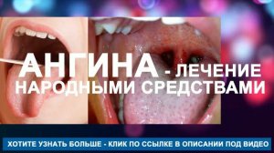 Ангина и перекись водорода