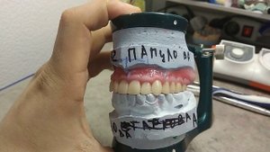 Моделирование десны съёмного протеза