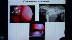 Коллапс трахеи у собак. Диагностика и лечение