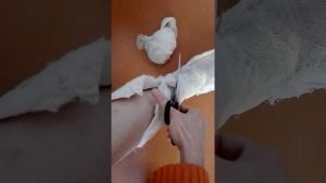 Перелом лодыжки. Снимаю гипс . 3 недели. Дома.