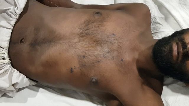 CVS Examination (Auscultation), Dept. of Medicine, JNMC. смотреть онлайн