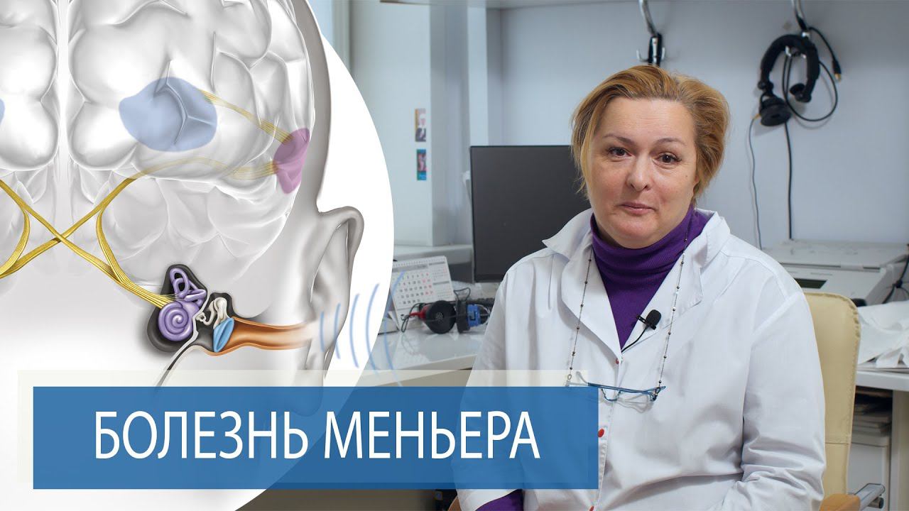 Внутреннее ухо | БОЛЕЗНЬ МЕНЬЕРА смотреть онлайн