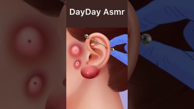 ASMR Eliminar pus piercing  ASMR Treatment of infections caused by wearing facial piercings #asmr