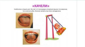 Артикуляционная гимнастика для детей. Артикуляционное упражнение Качели для языка. Детский логопед.