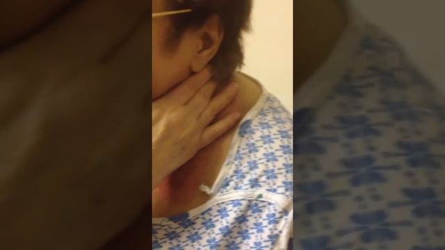 Ожег после лучевой терапии. Оплошность врача!! смотреть онлайн