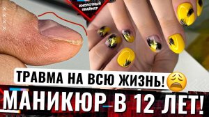 ?ЕЙ ОТКАЗАЛИ ВСЕ САЛОНЫ! Сложные грифозные ногти? БЕРЕГИТЕ СВОИ РУЧКИ!?  Коррекция клюющих ногтей
