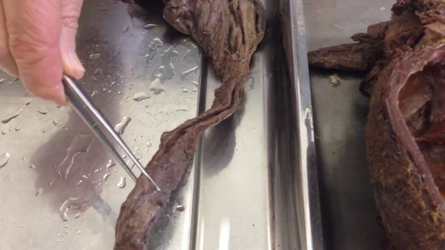 Строение глотки, пищевода, желудка смотреть онлайн