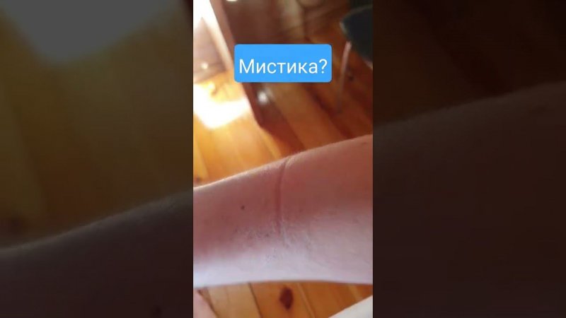 Полоска на руке  всё продолжается