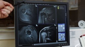 Что делает оператор МРТ или рентген-лаборант?