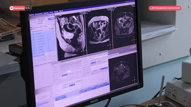 Круглый стол в рамках проекта «Онкопатруль»