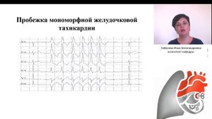 Интерпретация ЭКГ.  Кабанова И.А.