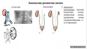 Эмбриогенез мочевой системы
