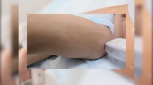 Magic One - диодный лазер для эпиляции