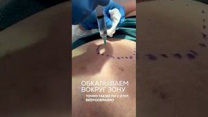 ТРОХАНТЕРИТ