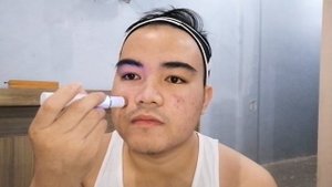 #Day1 KD-7910 Blue Light ACNE Lacer Treatment Review