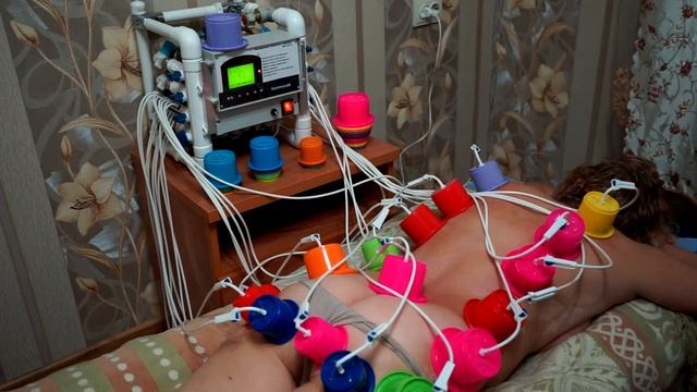 Вакуумный массаж с аппаратом Баночник КВС-2 смотреть онлайн