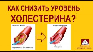 Как снизить холестерин в крови