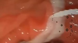 Бычий цепень