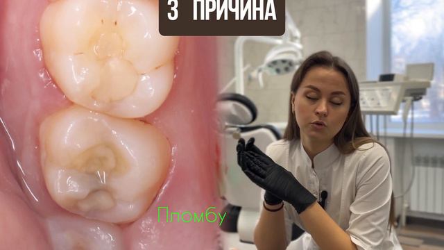 Когда нужно заменить пломбы? Причины для замены пломб