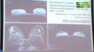 О побочном действии имплантов в молочные железы