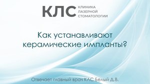Как устанавливают керамические импланты? Отвечает главный врач КЛС Белый Д.В.