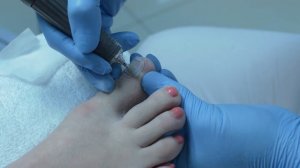 Протезирование ногтевой пластины