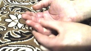 Порез сухожилий 4 пальцев 40 дней