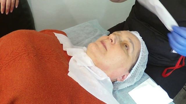 Всесезонные пилинги (поверхностные). Мастер-класс от эксперта ППИЭ Татьяны Игоревны Роменец