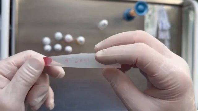 Проба на резус совместимость - Rh-compatibility test смотреть онлайн