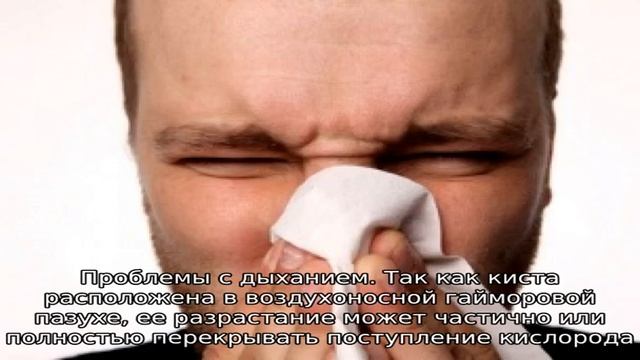 Симптоматика и особенности кисты гайморовой пазухи