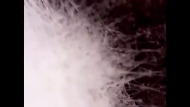 Плесень на старом яблоке | Под микроскопом | Увеличение 80х смотреть онлайн