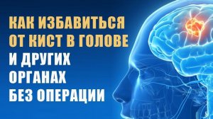 Как избавиться от кисты без операции народными способами