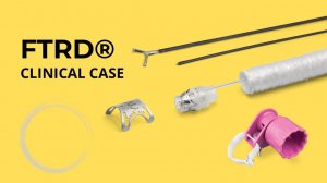 Клинический случай применения upper FTRD®