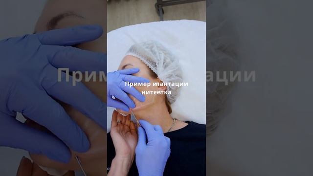 Мезонити «Сетки». Естественный объем без утяжеления лица смотреть онлайн