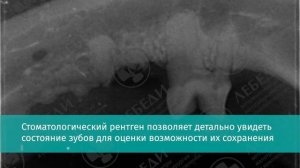 Удаление зубов у кошки