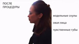 Косметология. 3D моделирование лица