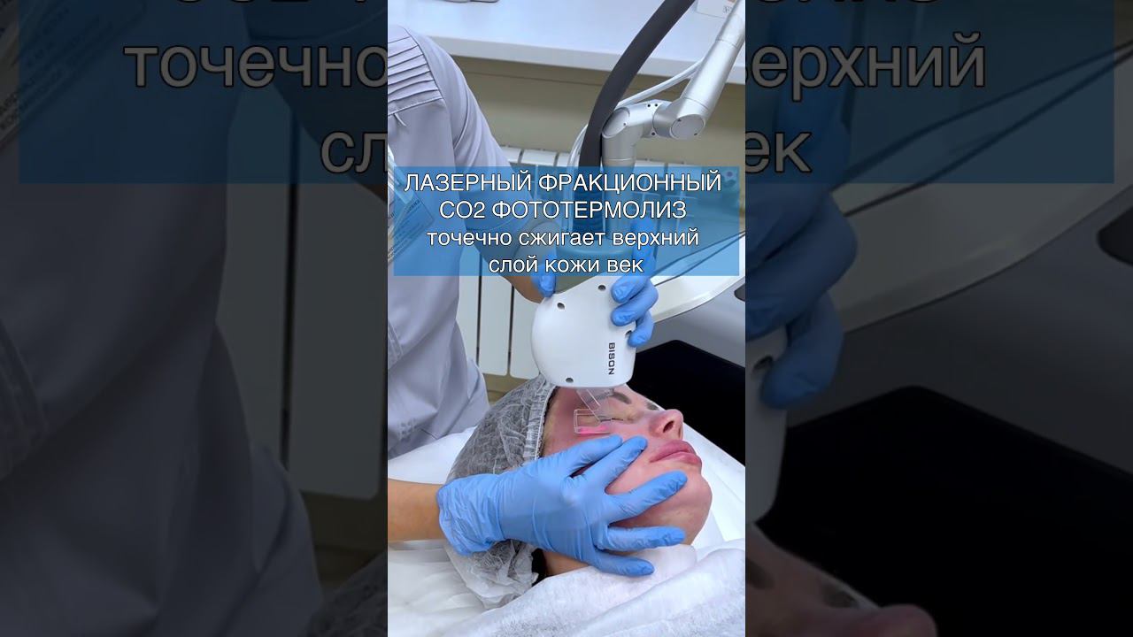 ЭФФЕКТИВНАЯ АППАРАТНАЯ КОМБИНАЦИЯ ДЛЯ ЛИФТИНГА ВЕК смотреть онлайн